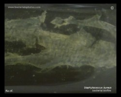 bacterial biofilm formed by staphylococcus aureus
